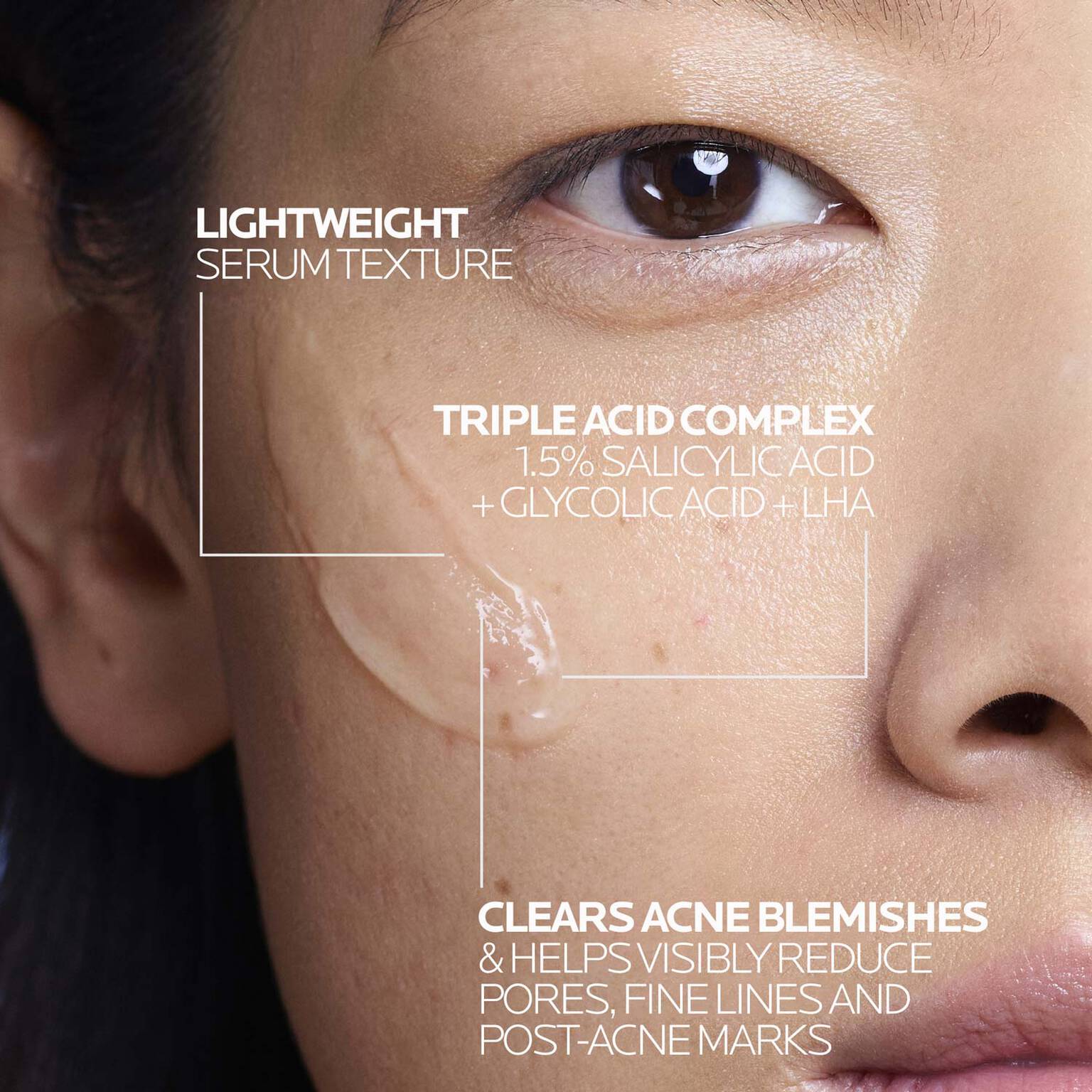 effaclar-salicylic-acid-acne-treatment-serum-s6 LaRochePosay-Product-Effaclar-Effaclar-Serum-30ml-3337875722827-Texture-REV.jpg