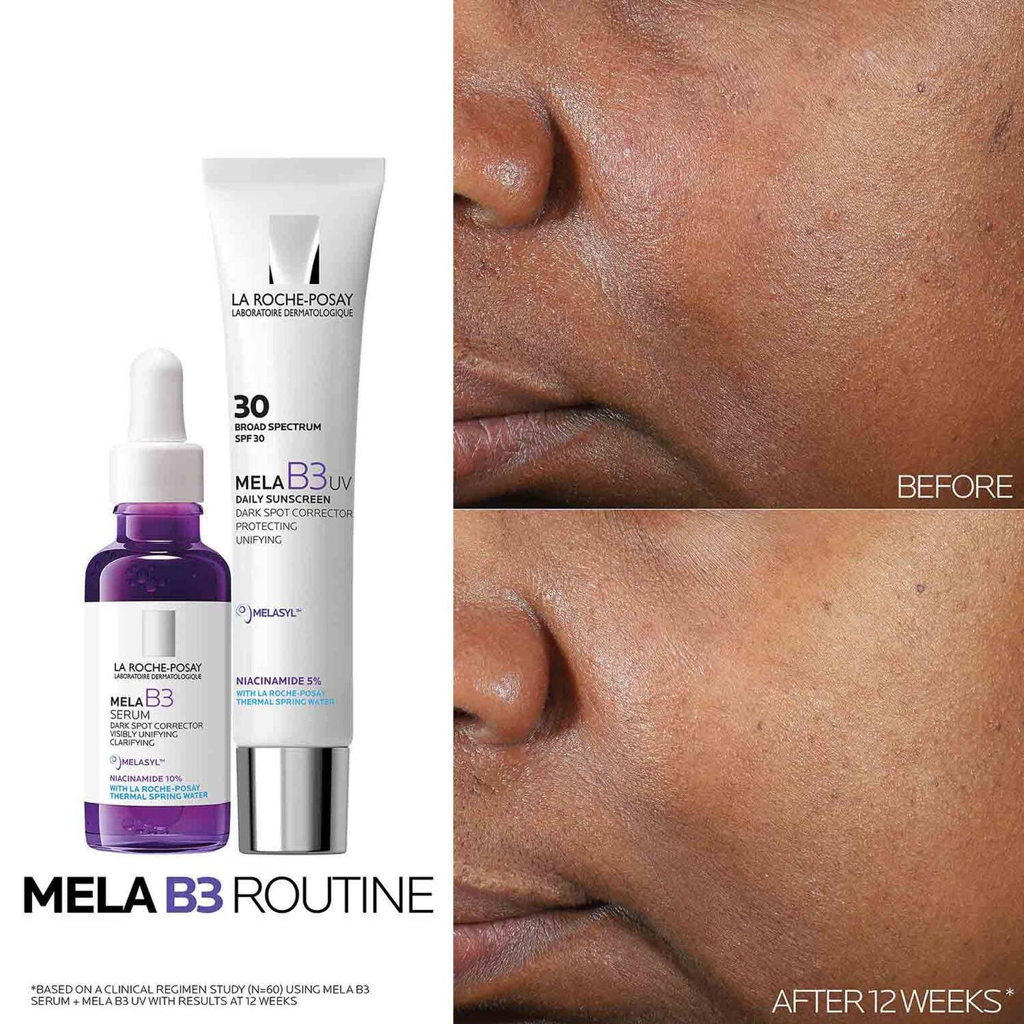 mela-b3-dark-spot-serum-with-melasyltm-niacinamide-l0 Mela-B3-routine_1500X1500.jpg